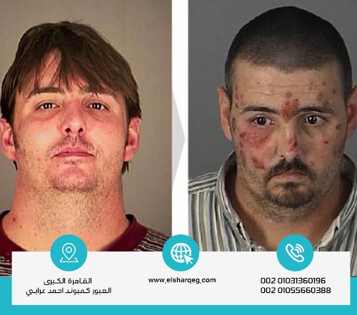 أعراض إدمان الشبو أو أضراره