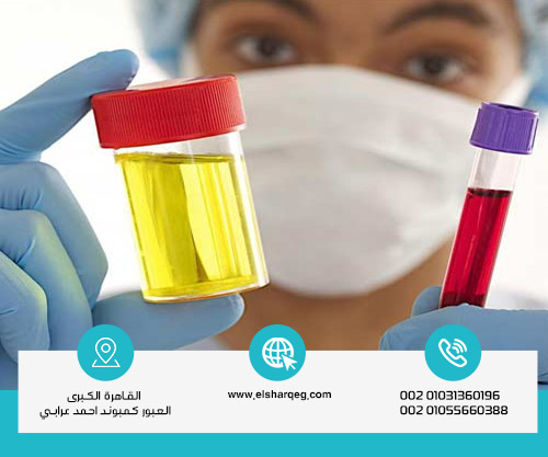 مدة بقاء الكبتاجون في البول والدم