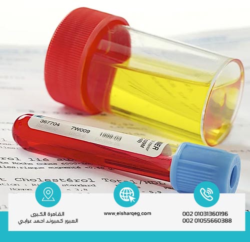 الفرق بين مدة بقاء الحشيش والماريجوانا في الدم والبول عند التحليل؟