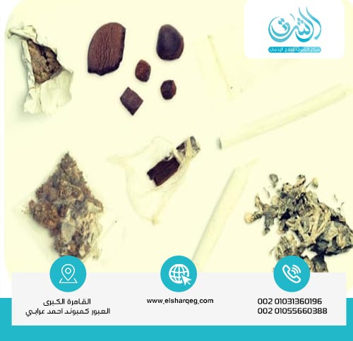 ما هي أنواع الحشيش