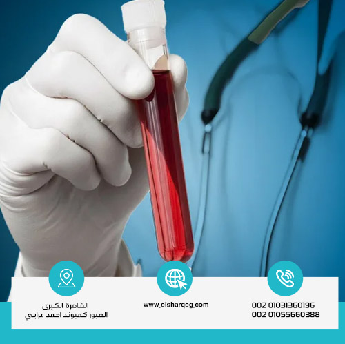 مدة بقاء الحشيش في الدم