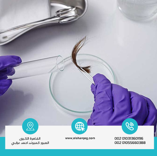 مدة بقاء الحشيش في الشعر