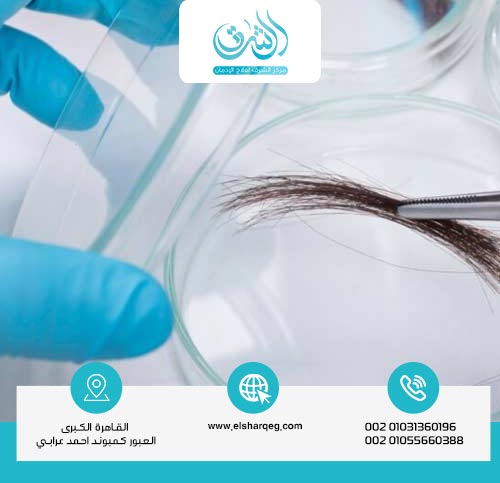 مدة بقاء مخدر الشعر في الجسم