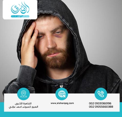 اعراض انسحاب الحشيش عند التوقف المفاجئ