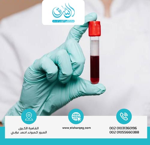 العوامل التي تؤثر على مدة خروج الكبتاجون