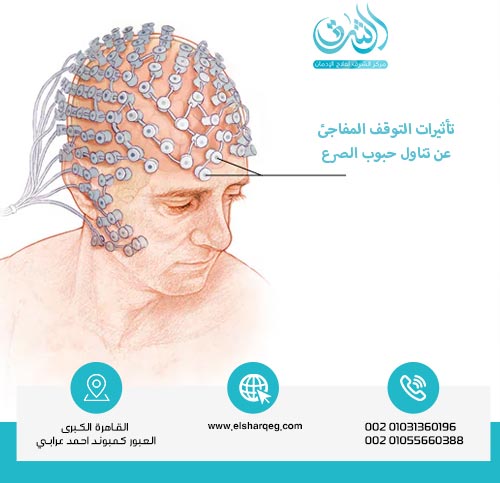 تأثيرات التوقف المفاجئ عن تناول حبوب الصرع