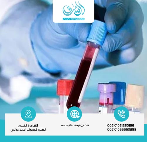 طرق تقليل مدة بقاء المخدرات في الجسم بشكل آمن