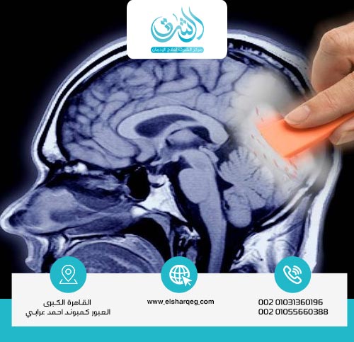 طرق علاج الذهان نهائيًا ؟