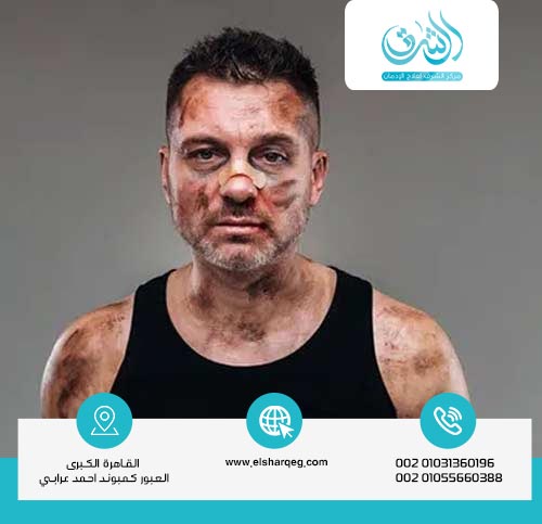 كيف يؤثر الشبو على الدماغ والجسم؟