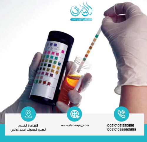 مدة بقاء الفنتانيل في الجسم وتأثيرها على التحليل والعلاج