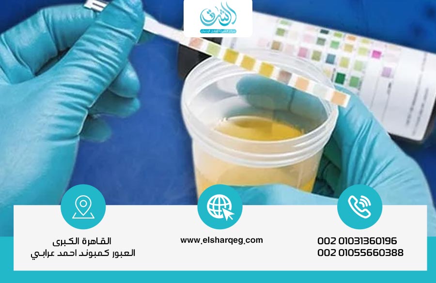 مدة بقاء الكبتاجون في الدم والبول وكيفية التخلص منه بسرعة