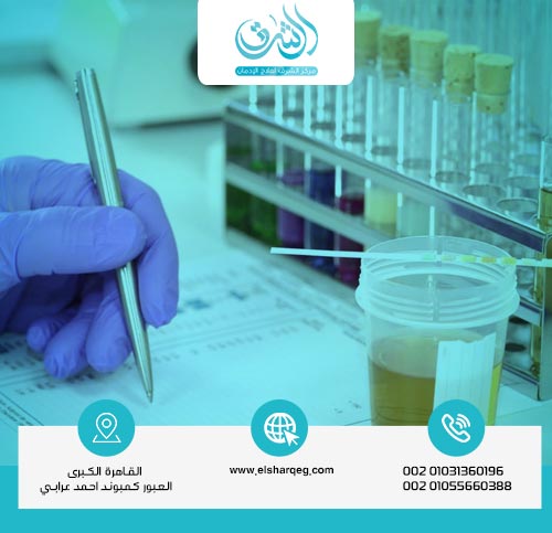 مدة بقاء المخدرات في الجسم والبول والدم