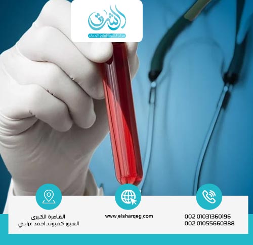 Duration of Cannabis in Blood