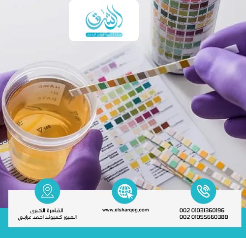 هل وضع الماء مع البول يفسد تحليل المخدرات؟