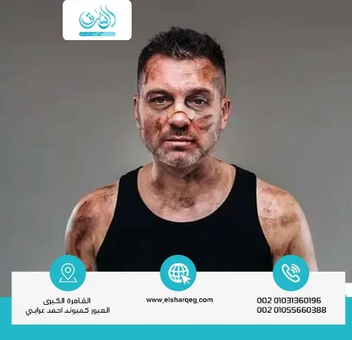 العلاقة بين إدمان الشبو وارتكاب الجرائم