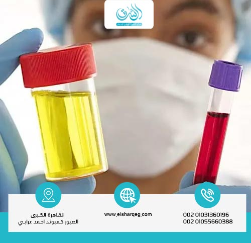 ما هي مدة بقاء دواء الجابابنتين في البول والدم؟