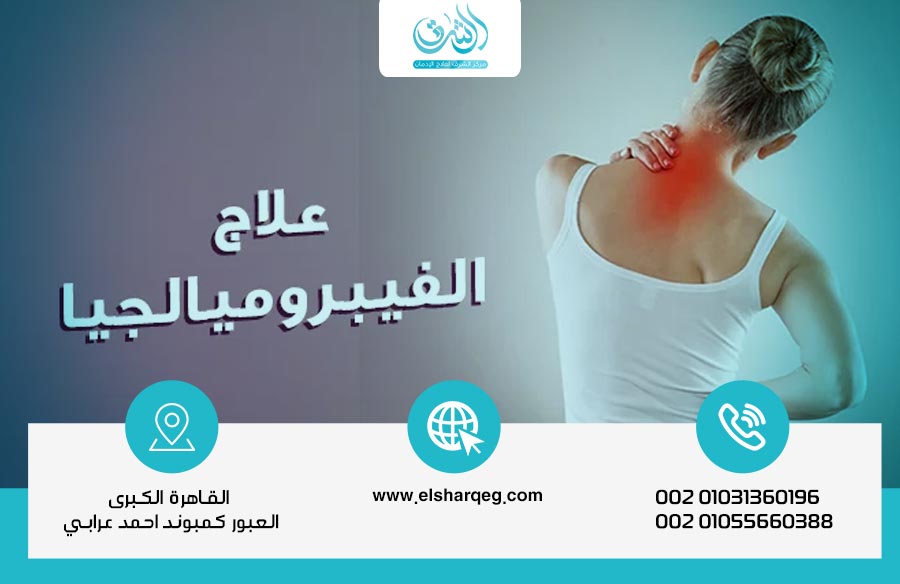 مرض فيبروميالجيا؟ هل هو مرض نفسي أم عضوي؟ Fibromyalgia