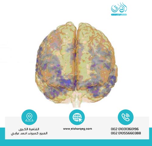 كيف يؤثر الكوكايين على الدماغ قبل بدء العلاج؟