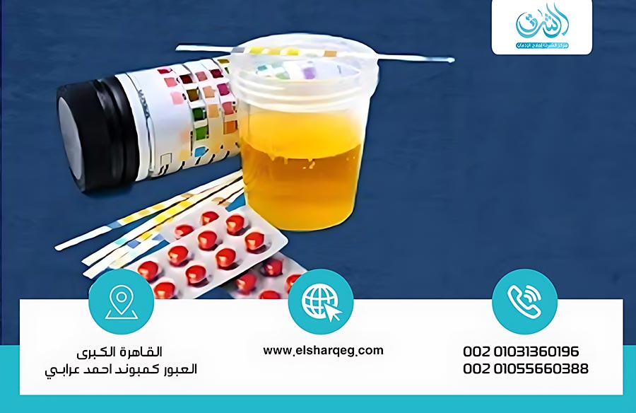 مدة بقاء الترامادول في البول والدم